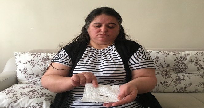 Karın ağrısı şikayetiyle hastaneye giden kadının midesinden çıkan şok etti