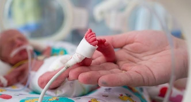 Her yıl doğan 15 milyon prematüre bebekten 1 milyonu hayatını kaybediyor