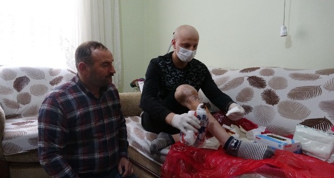 210 bin lira bulamazsa bacağı kesilecek