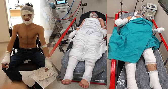 Evi yakmak isterken kendini ve arkadaşlarını yaktı