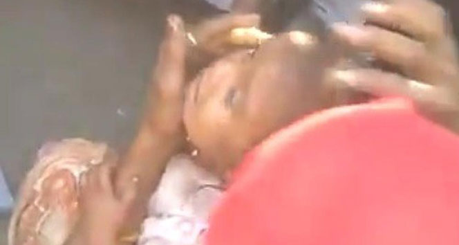 Kafası tencereye sıkışan küçük kızı kurtarma operasyonu