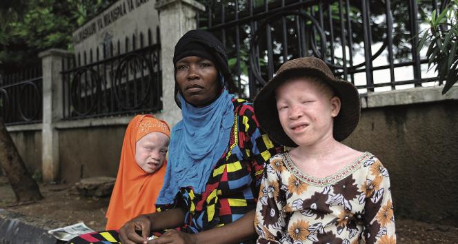 Afrikalı albinoların yaşamı İKÜSAG’da