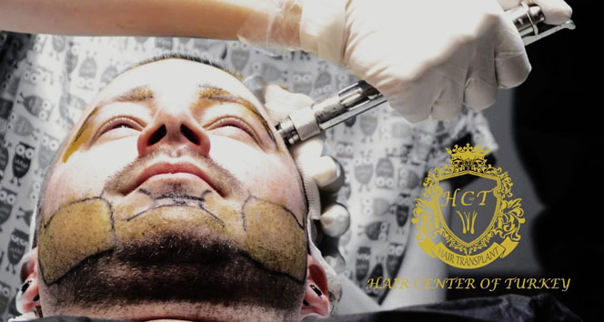 Hair Center of Turkey’de ağrısız ve tıraşsız saç ekimi ayrıcalıklarını yaşayın