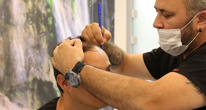 DoctorZen Medikal Direktörü Zengin, saç ekiminde ‘Fiber Fue’ yöntemini anlattı