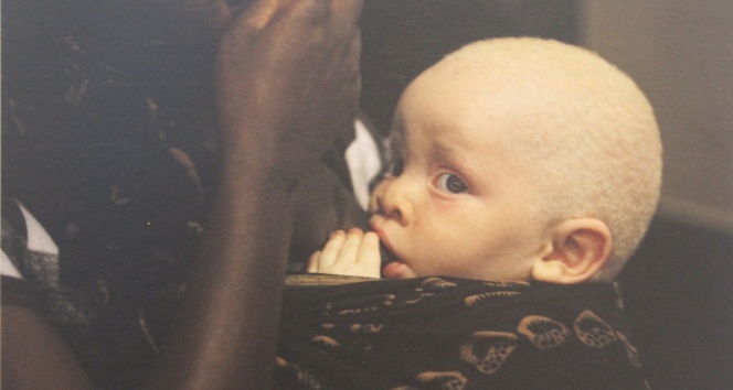 Kara kıtanın beyaz dramı “Tanzanyalı albinolar” İKÜSAG’da