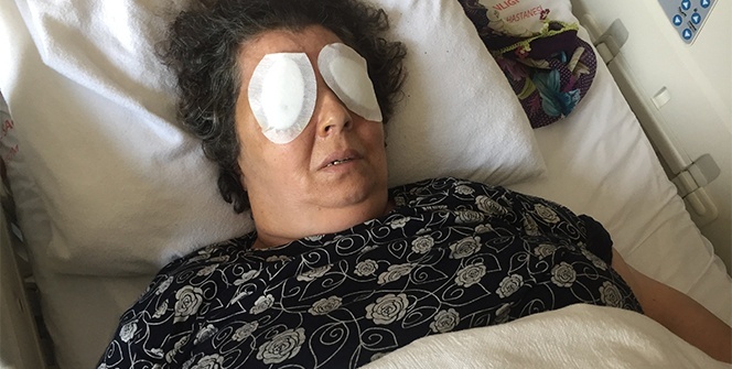 Hastanede dehşet: Şizofren kadın, bir hastanın gözlerini çıkardı