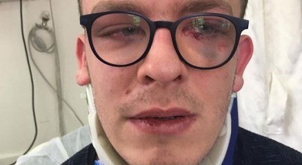 Avcılarda Otizimli genç sokak ortasında dehşeti yaşadı