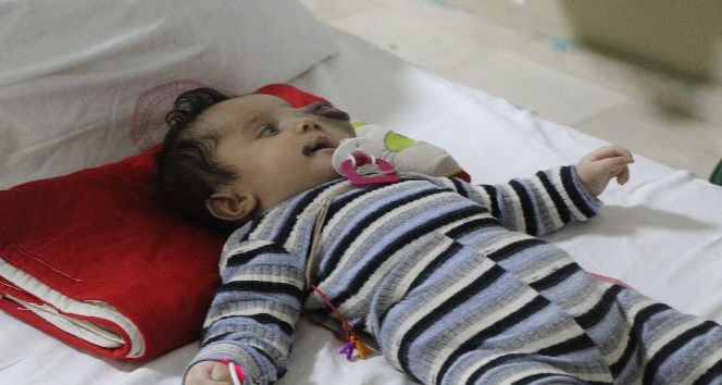 Suriyeli Yusuf bebek Türkiye’de tedavi ediliyor