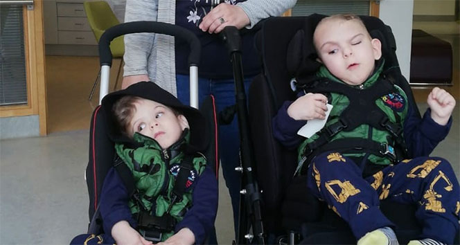 Antalyalı siyam ikizleri ayrıldı