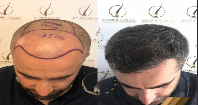 İstanbul Hairline CEO’su Gülşen Şener: “Çalışanlarımızı düzenli aralıklarla PCR testinden geçiriyoruz”