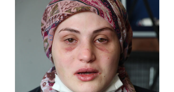 Kaçarak evlendiği eşi, genç kadına kabusu yaşattı