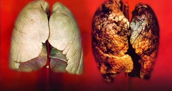 Beta karoten akciğer kanseri riskini arttırıyor
