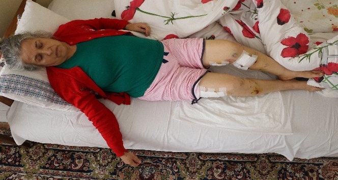 Sokak köpeklerinin saldırısına uğrayan yaşlı kadın ölümden döndü