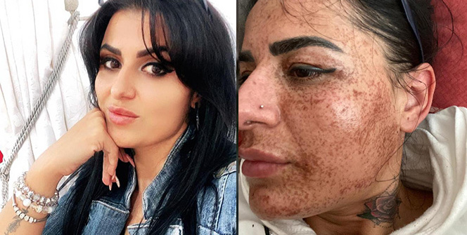 Sosyal medyada gördüğü cilt toparlama ilanıyla hayatı kabusa döndü