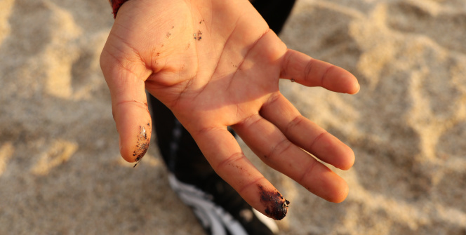 Sahilde ayaklara yapışan zift şaşkına çevirdi