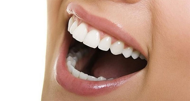 Telsiz Ortodonti Tedavisi