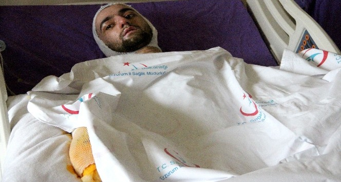 Banyo yapmak için sobaya benzin döktü, feci şekilde yandı