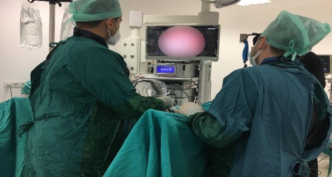 Çarşamba Devlet Hastanesi’nden ‘prostat’a erken müdahale