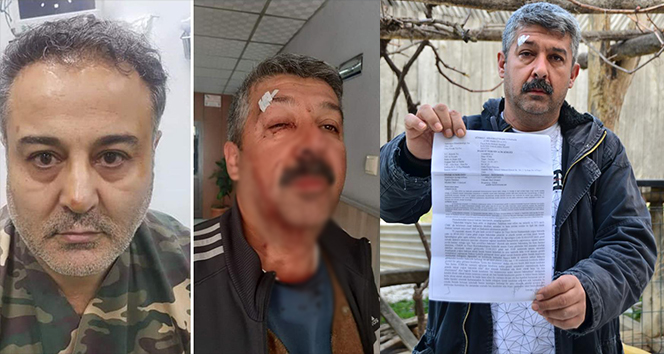 Ordu'daki doktora darp olayı