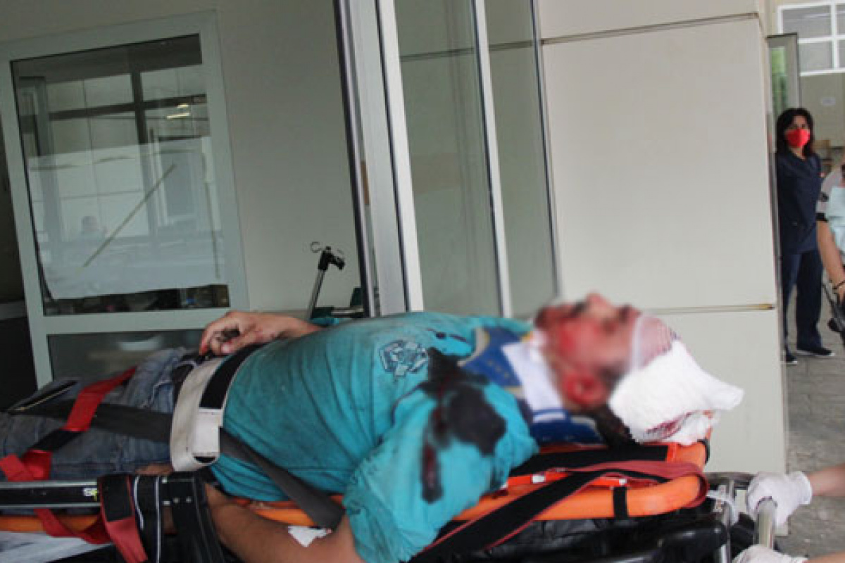 Çatı çöktü, tadilat yapan vatandaş yaralandı