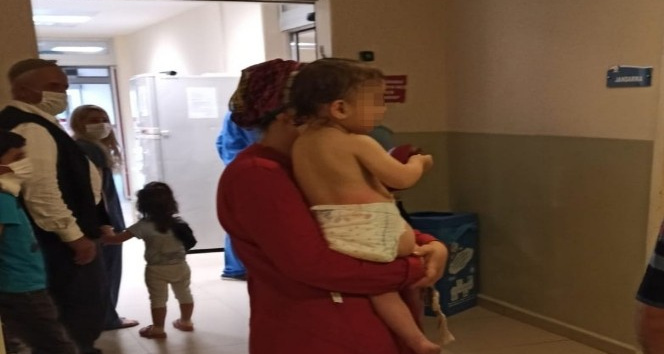 İkiz bebeklerin üzerine kaynar su döküldü
