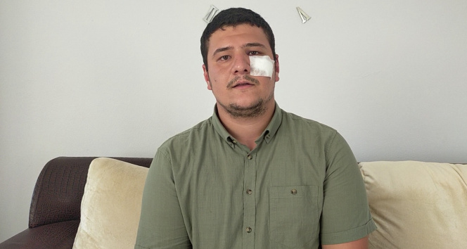 İHA muhabirini darp eden saldırganların ifadeleri pes dedirtti