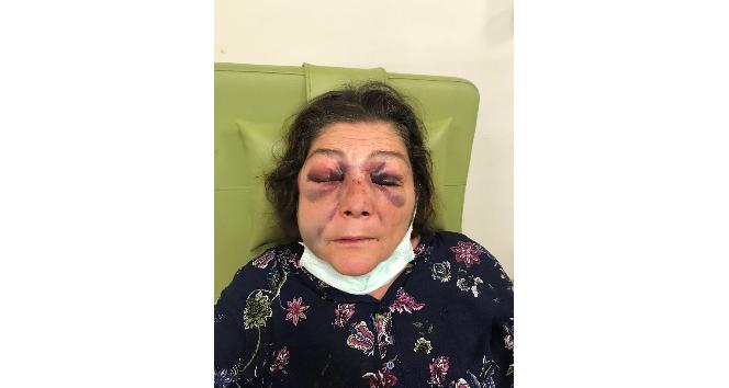 AK Kadınlar, Eynesil’deki kadına yönelik şiddeti kınadı