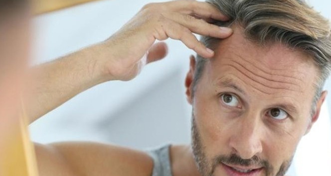 Uzmanından saç ekimine dair 6 maddede doğru bilinen yanlışlar