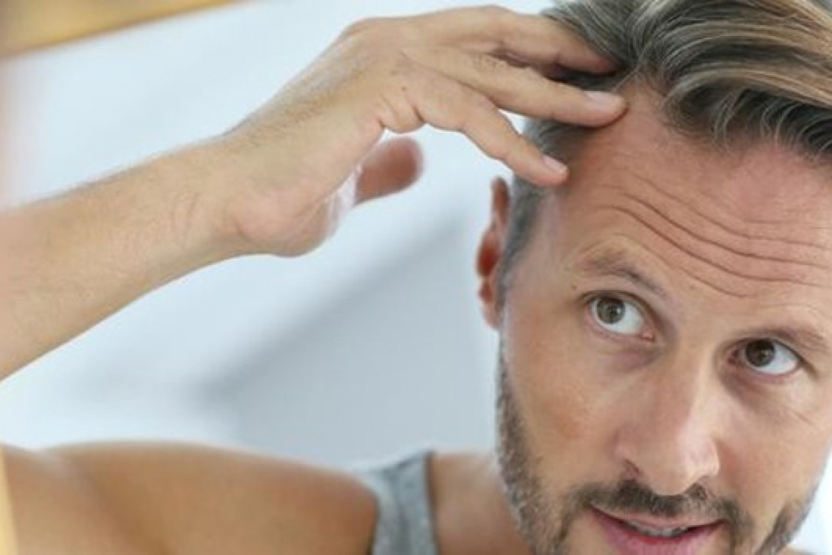 Uzmanından saç ekimine dair 6 maddede doğru bilinen yanlışlar