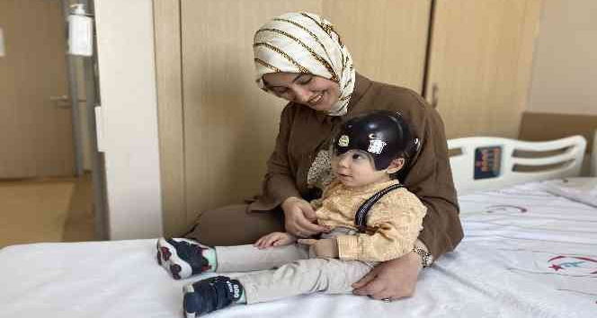 Bebeklerde kafatası şekil bozukluğuna dikkat!