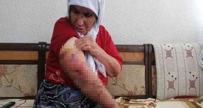 Köpeğin saldırısına uğrayan kadın ölümden döndü