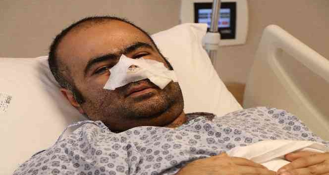 Pitbullun kopardığı buruna estetik yama