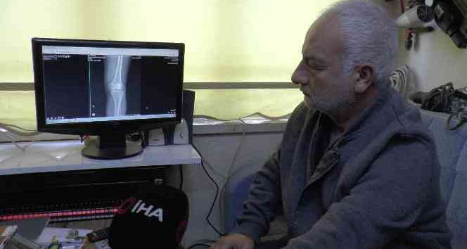 Diz kapağındaki mermi 13 gün sonra fark edildi