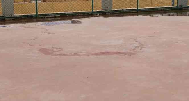 Pitbull cinsi iki köpeğin saldırdığı 4 yaşındaki çocuk ağır yaralandı