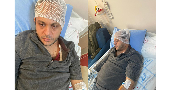 Gaziantepte hasta yakınından doktora mermerli saldırı