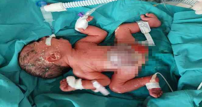 Siirt’te ambulans uçak 2 günlük bebek için havalandı