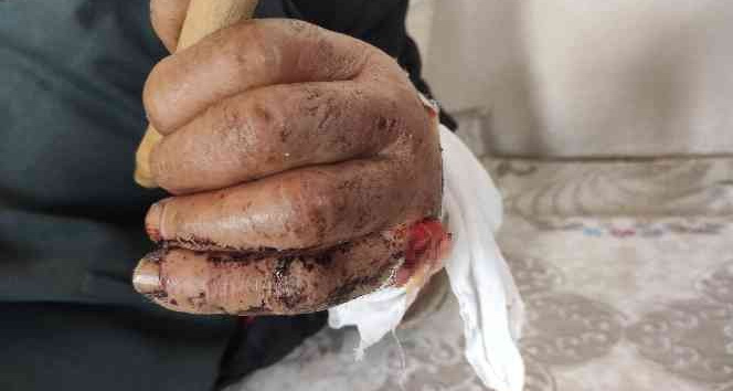 Mardin’de kimliksiz, yaşlı, kimsesiz adam ’sokak köpeği’ saldırısına uğradı