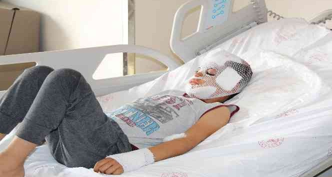 Mardin’de sokak köpeklerinin saldırısına uğrayan çocuk konuştu