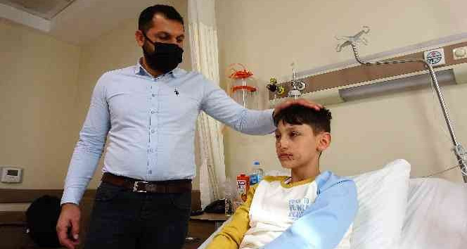 Minik Asiye gibi yüzünden yaralanan Berat’tan sevindiren haber