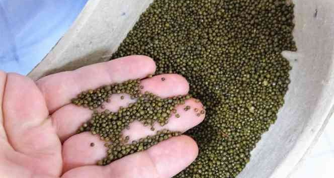 Safra kesesinden çıkanlar şaşırttı, Guinness’e başvuru yapacaklar