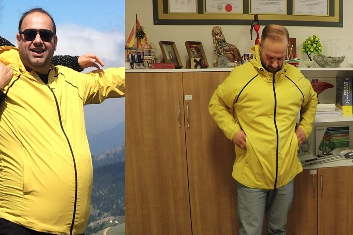 1,5 yılda 55 kilo verdi, 140 kilodan 85 kiloya düştü