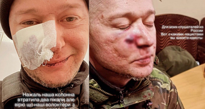 Orduya katılan Ukraynalı müzisyen, Rus saldırılarında yaralandı