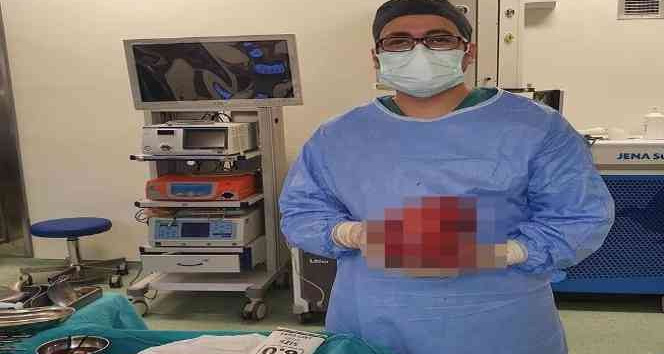Karnından futbol topu büyüklüğünde tümör çıktı