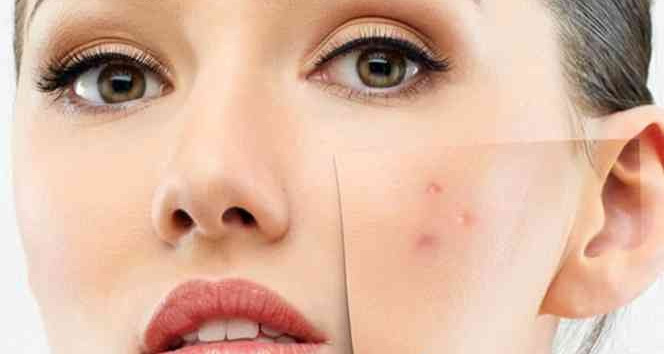 Hassas ve alerjik ciltlere mevsim geçişlerinde dikkat