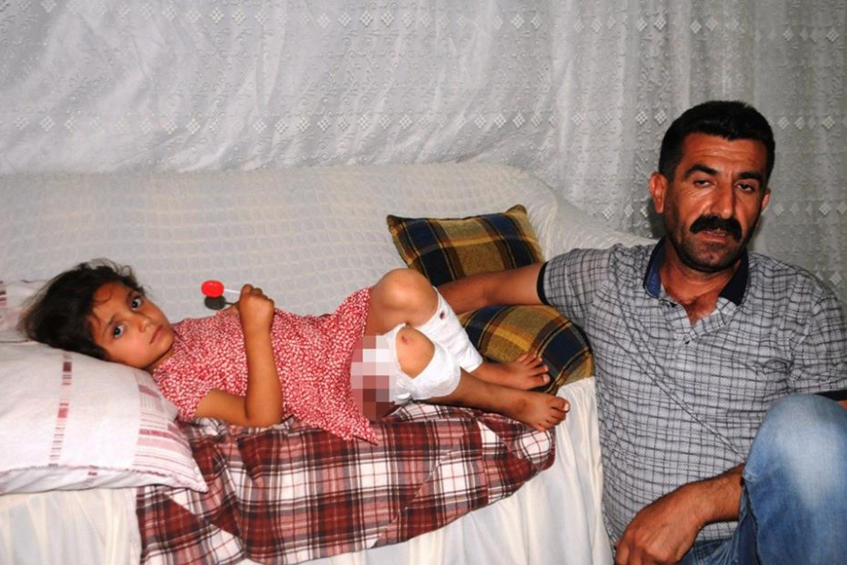 Başıboş köpeğin saldırısına uğrayan 5 yaşındaki çocuk yaralandı