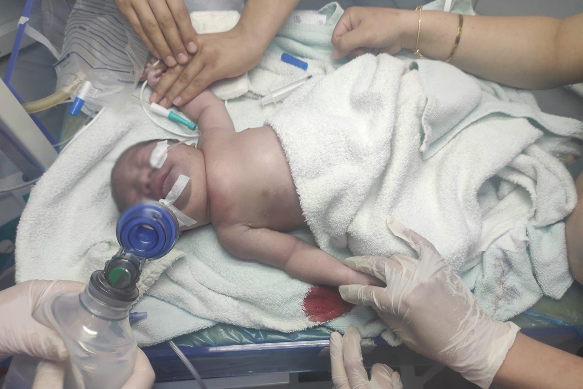 Yeni doğan bebeğin köprücük kemiği kırıldı, vücudu mosmor oldu