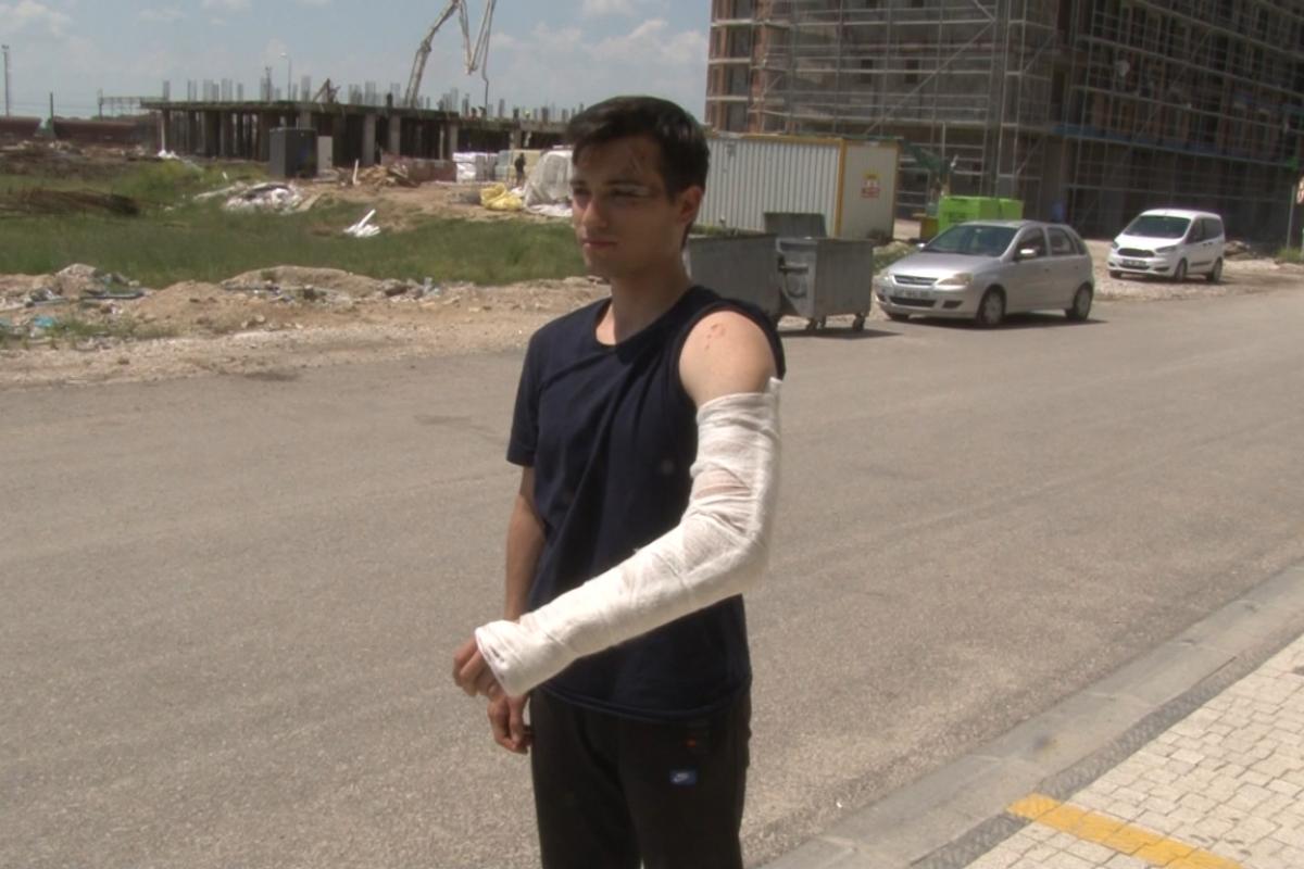 Bisikletiyle üniversiteye giden öğrenci sokak köpeklerinin saldırısına uğradı