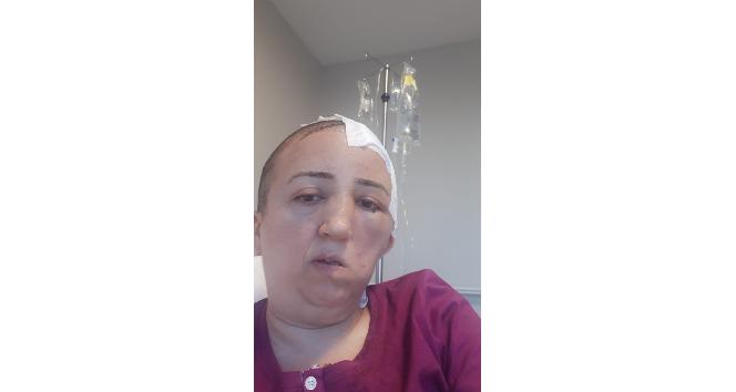 Kafatası kemiği kaybolmuştu, ameliyatla yenisi takıldı