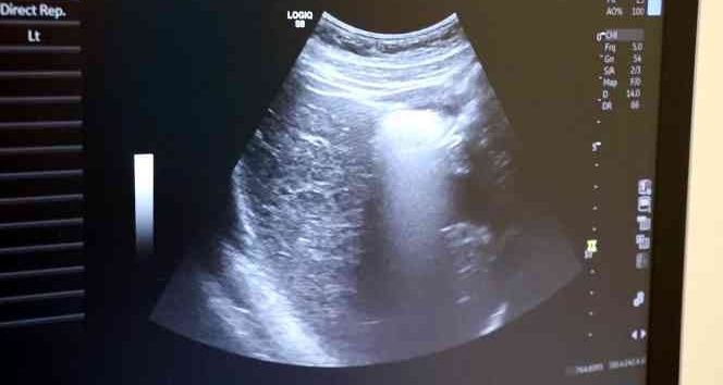 4 boyutlu ultrason ile bebeğin hastalıkları doğmadan anlaşılıp tedavi edilebiliyor