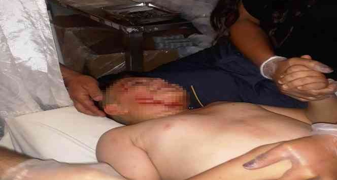 Köpeğin saldırdığı çocuk hastanelik oldu